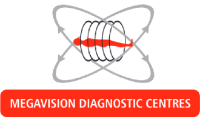 ECG Test in Pimpri Chinchwad | Megavision Diagnostics Centres